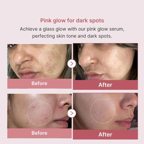 "Close-up of Medicube PDRN Pink Peptide Serum’s lightweight, slightly pink-tinted gel texture on skin."