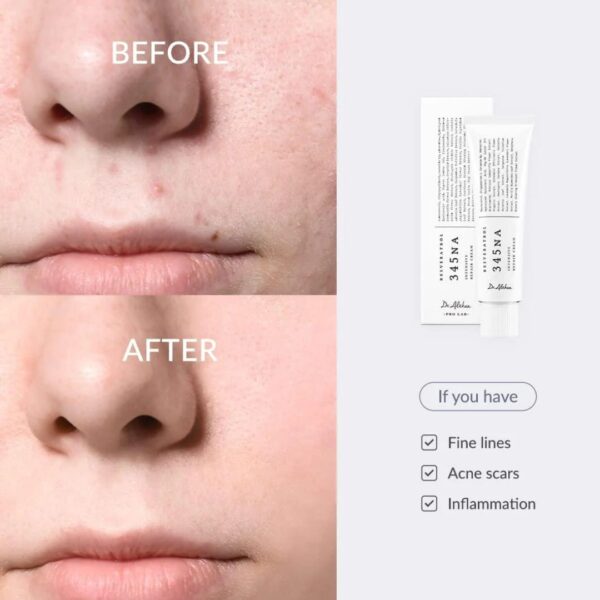 Lightweight creamy texture of Dr. Althea 345 Relief Cream on skin