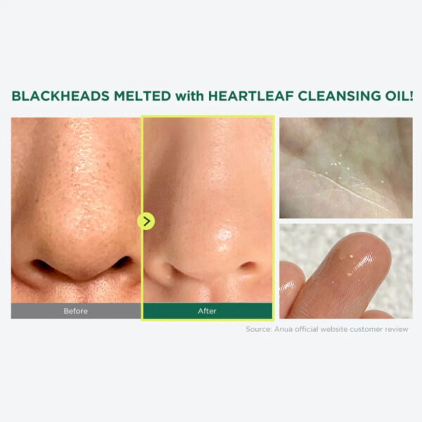 anua heartleaf pore control cleansing oil