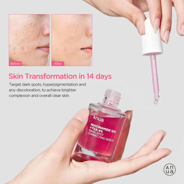 anua niacinamide 10% + txa 4% serum