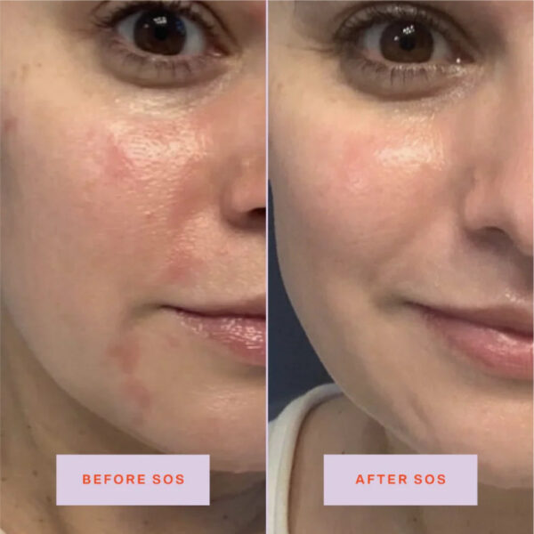"Close-up of Tower 28 SOS Rescue Facial Mist for sensitive skin hydration."
