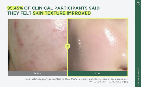 ANUA- Heartleaf 77 Toner Pad 70 Sheets, PHA Dead Skin Care Low pH Daily Toner Pad exfoliating - Image 2